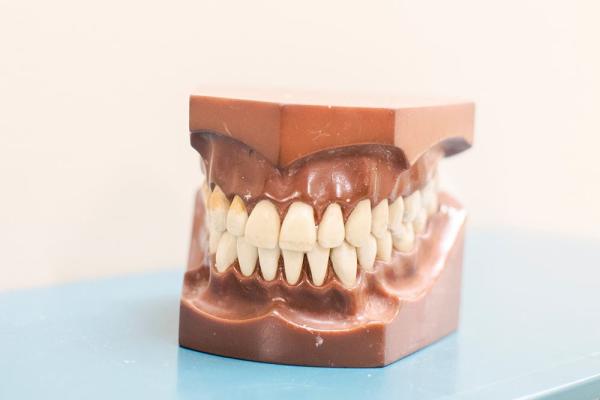 Yutma Bozuklukları Terapisi